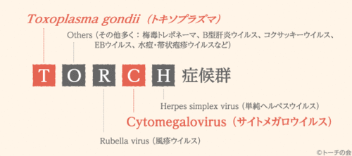 about_torch_name.gif